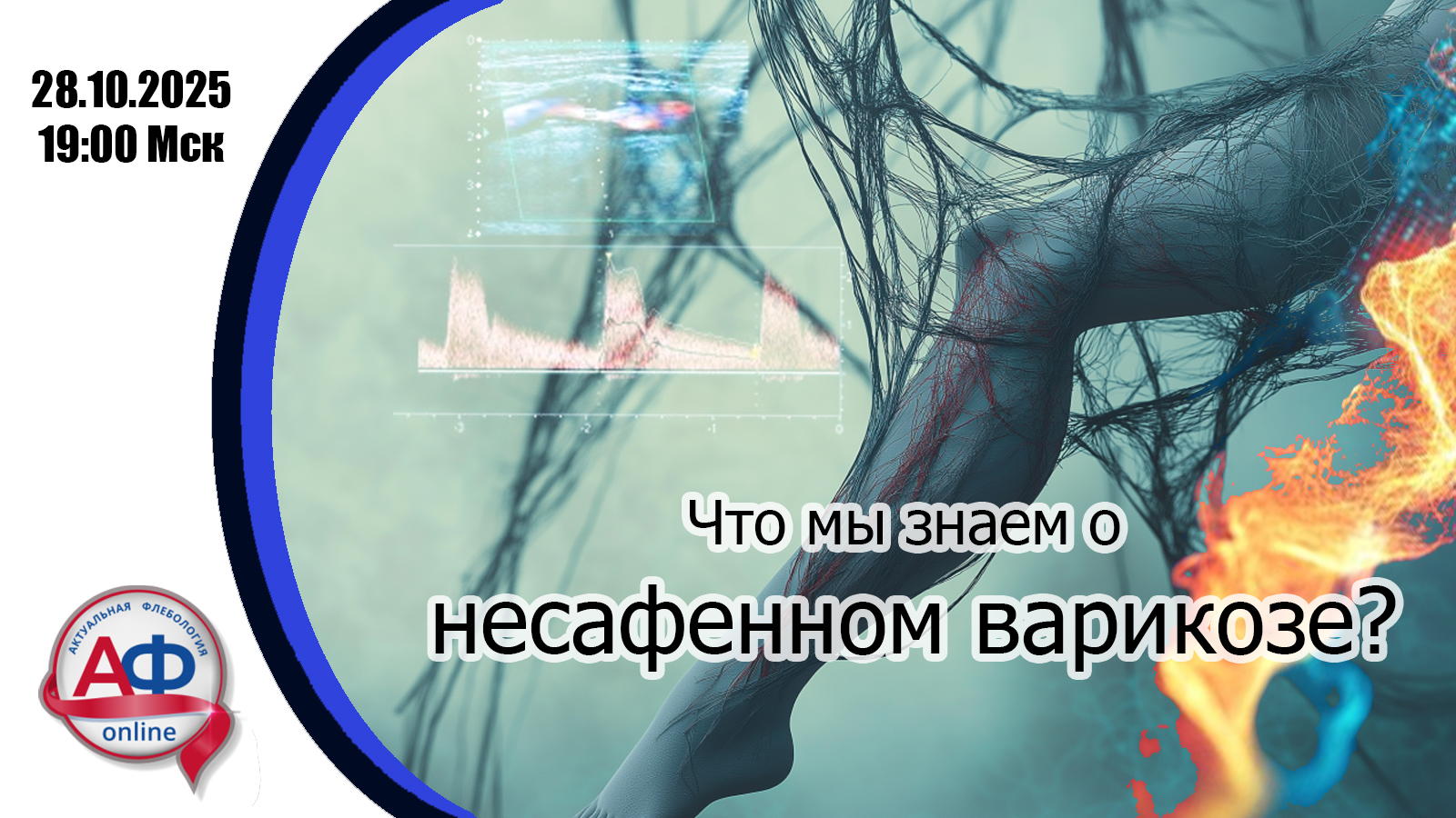Что мы знаем о несафенном варикозе?