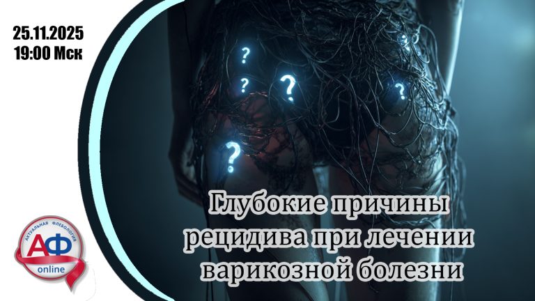 Глубокие причины рецидива при лечении варикозной болезни
