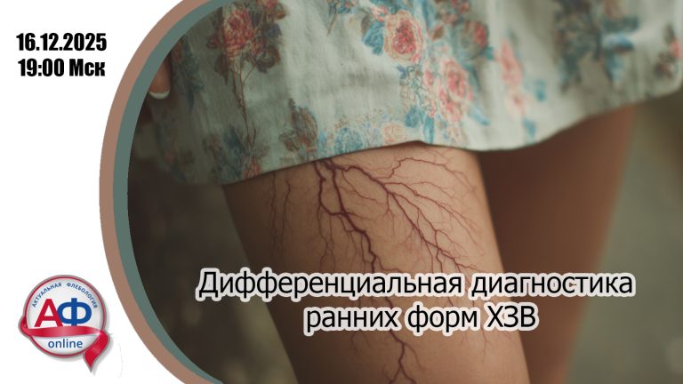 Дифференциальная диагностика ранних форм хронических заболеваний вен