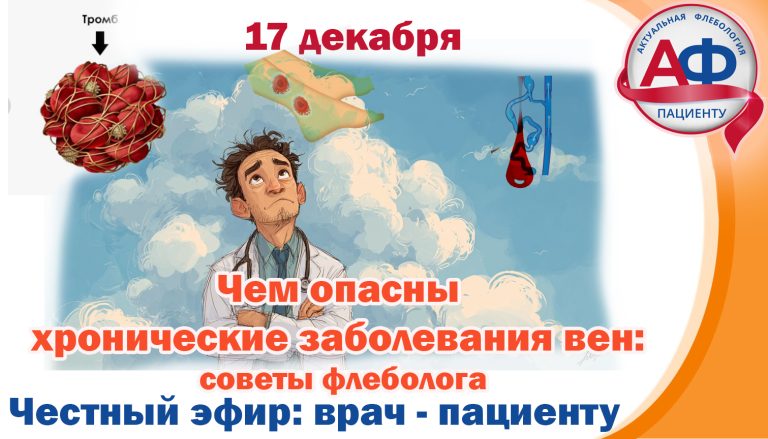 Чем опасны хронические заболевания вен? Советы флеболога