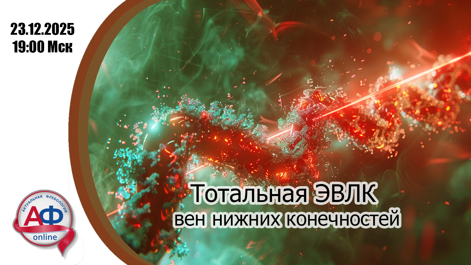 Тотальная ЭВЛК  вен нижних конечностей