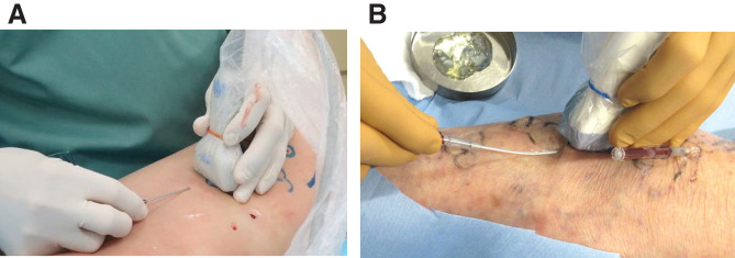 ЭВЛК притоков