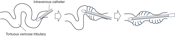 ЭВЛК притоков