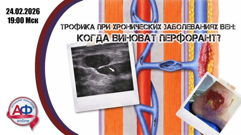 Трофика при хронических заболеваниях вен: когда виноват перфорант?