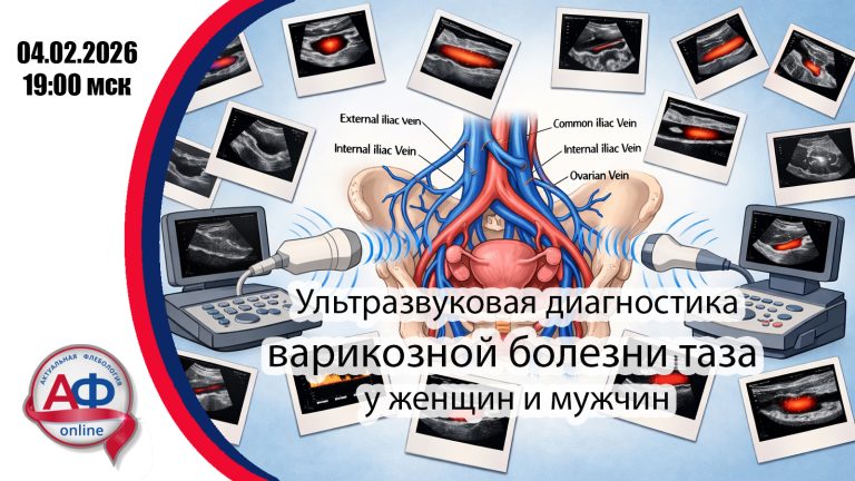 льтразвуковая диагностика варикозной болезни таза у женщин и мужчин