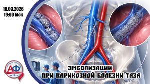 Эмболизации при варикозной болезни таза - Актуальная Флебология