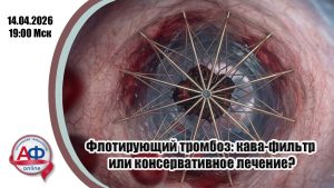 Флотирующий тромбоз: кава-фильтр или консервативное лечение? - Актуальная Флебология
