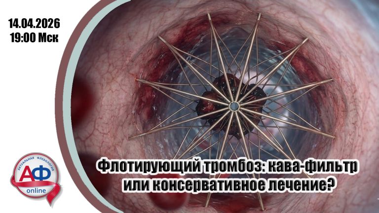 Флотирующий тромбоз: кава-фильтр или консервативное лечение?