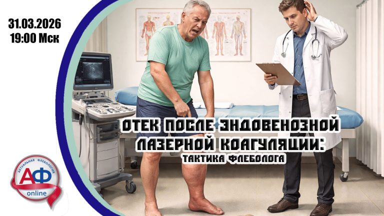 Отек после эндовенозной лазерной коагуляции: тактика флеболога