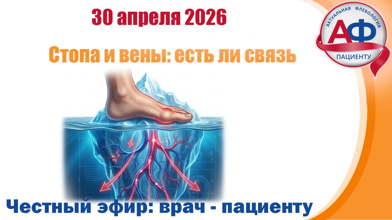Статья - Стопа и вены: есть ли связь?