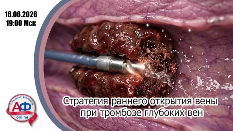 Стратегия раннего открытия вены