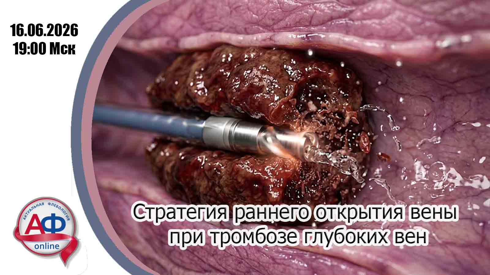 Стратегия раннего открытия вены