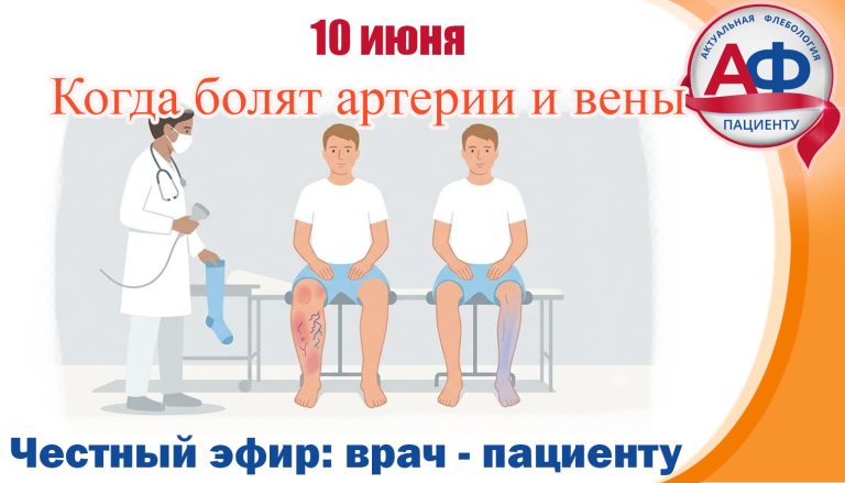 Когда болят артерии и вены?