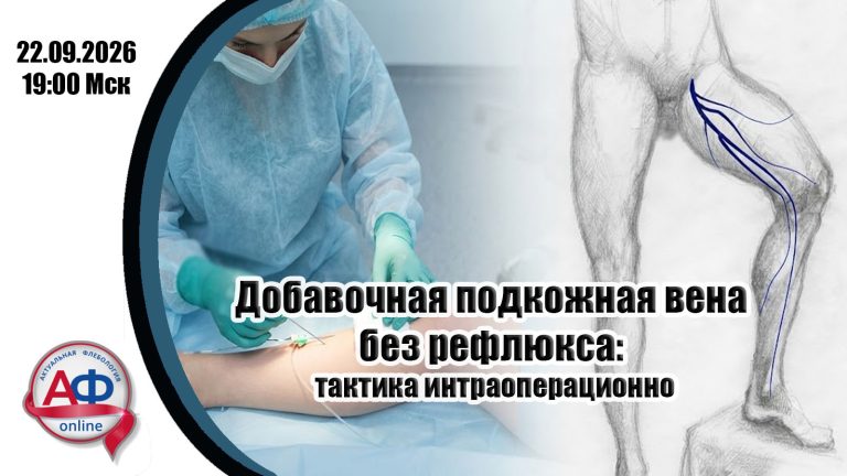 Добавочная подкожная вена без рефлюкса: тактика интраоперационно
