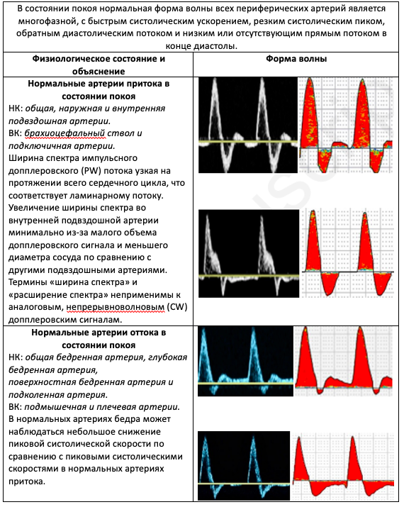 Интерпретация спектральных допплеровских кривых периферических артерий: практический разбор консенсуса SVM/SVU
