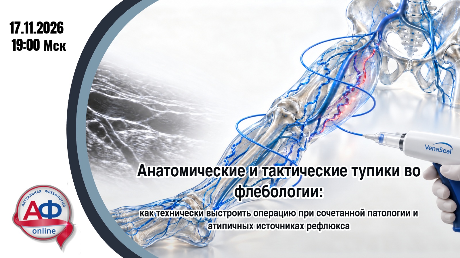 Анатомические и тактические тупики во флебологии: как технически выстроить операцию при сочетанной патологии и атипичных источниках рефлюкса