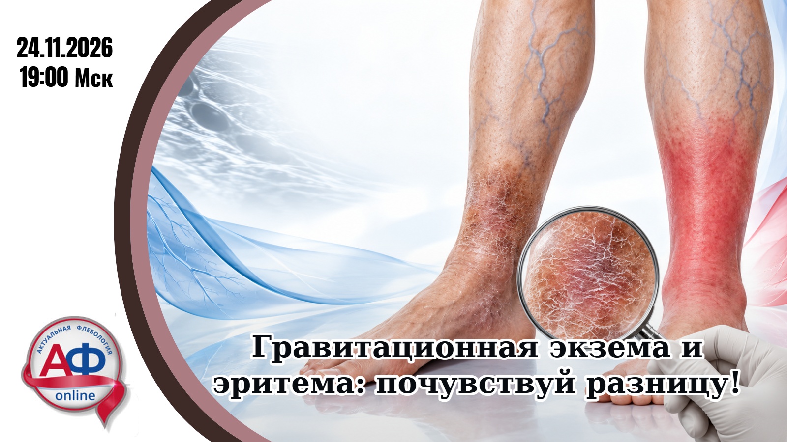 Гравитационная экзема и эритема: почувствуй разницу!
