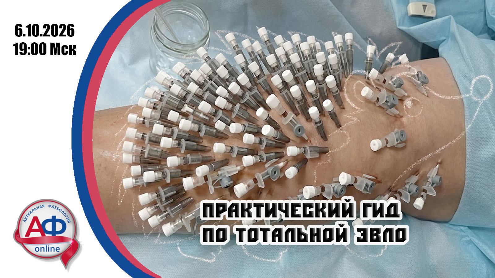 Практический гид по тотальной ЭВЛО